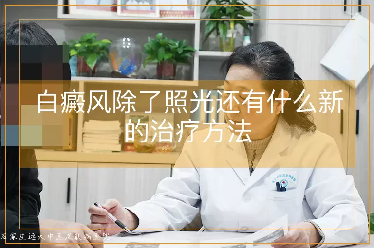 白癜风除了照光还有什么新的治疗方法