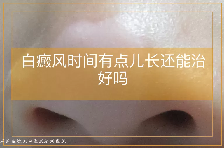 白癜风时间有点儿长还能治好吗