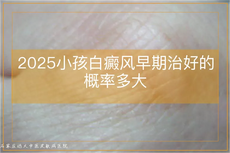 2025小孩白癜风早期治好的概率多大