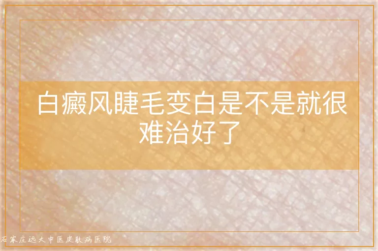 白癜风睫毛变白是不是就很难治好了