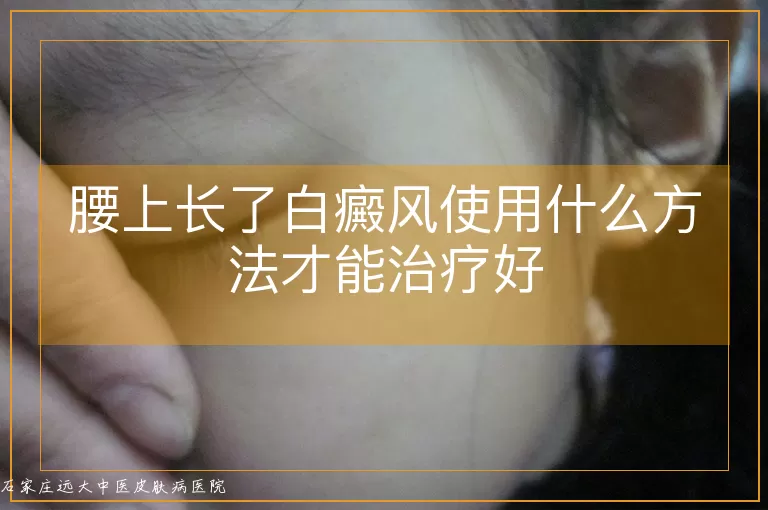 腰上长了白癜风使用什么方法才能治疗好