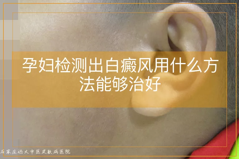 孕妇检测出白癜风用什么方法能够治好