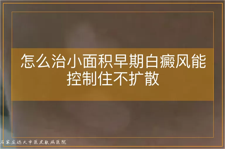 怎么治小面积早期白癜风能控制住不扩散