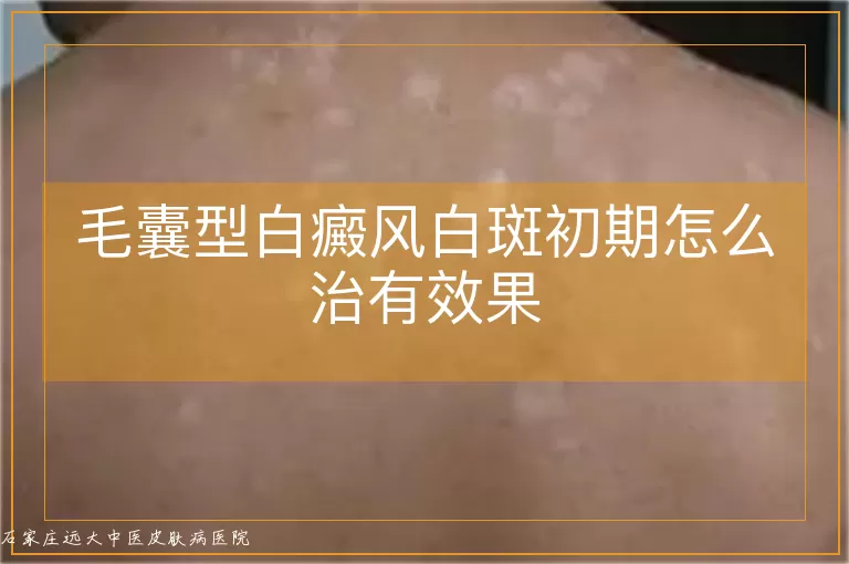 毛囊型白癜风白斑初期怎么治有效果