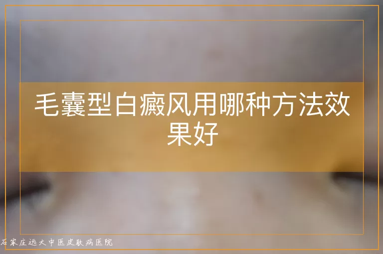 毛囊型白癜风用哪种方法效果好