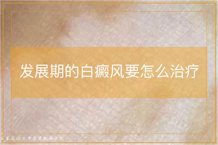 发展期的白癜风要怎么治疗