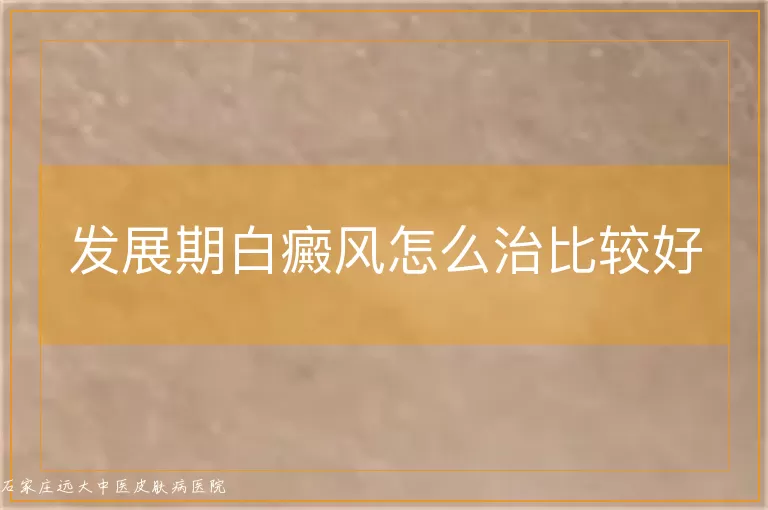 发展期白癜风怎么治比较好