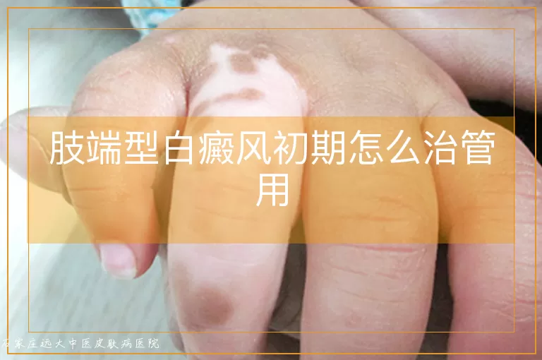 肢端型白癜风初期怎么治管用