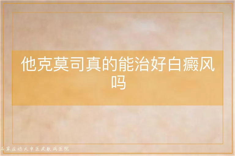 他克莫司真的能治好白癜风吗