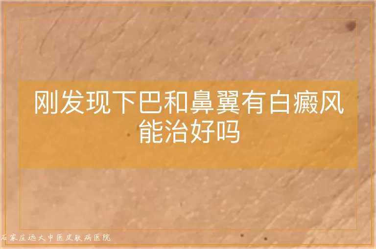 刚发现下巴和鼻翼有白癜风能治好吗