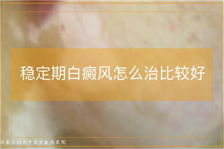 稳定期白癜风怎么治比较好