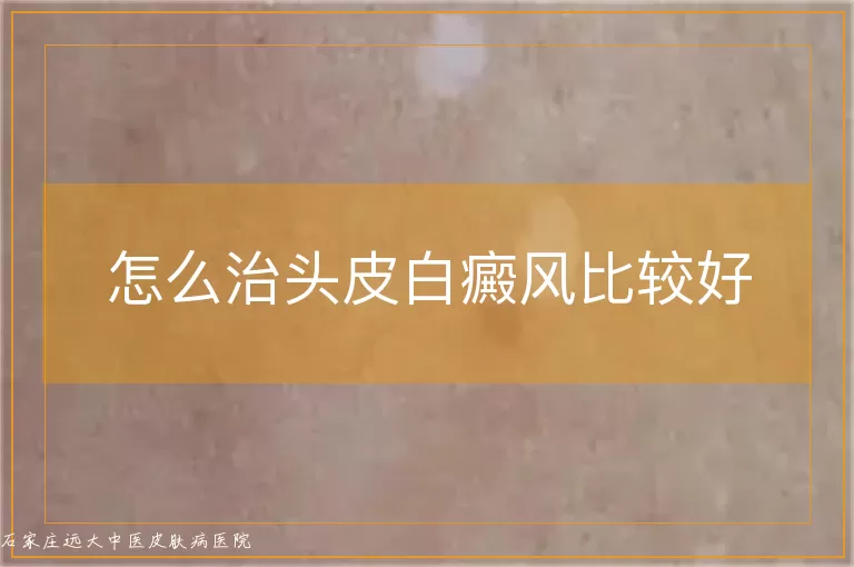 怎么治头皮白癜风比较好