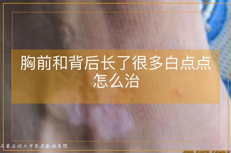 胸前和背后长了很多白点点怎么治
