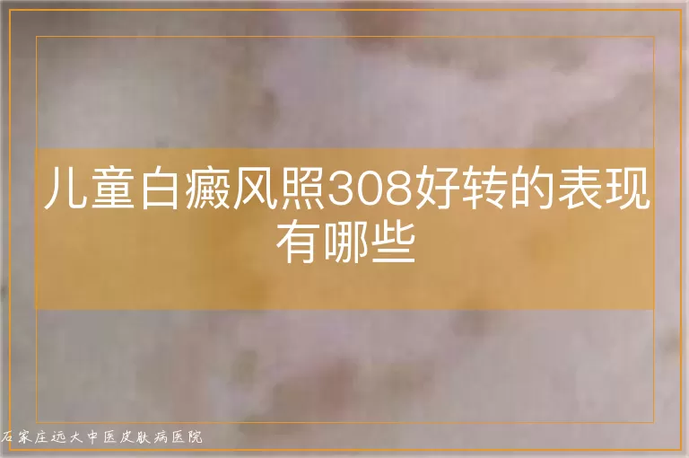 儿童白癜风照308好转的表现有哪些