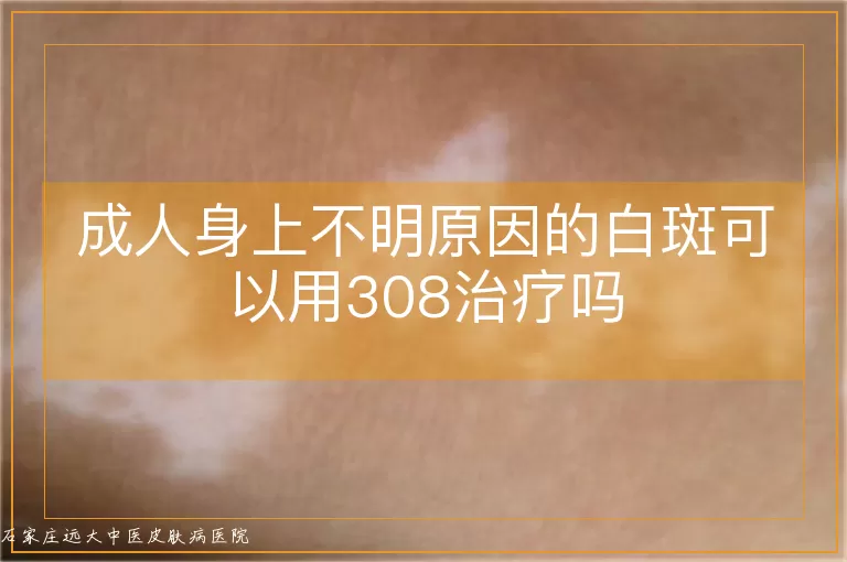 成人身上不明原因的白斑可以用308治疗吗