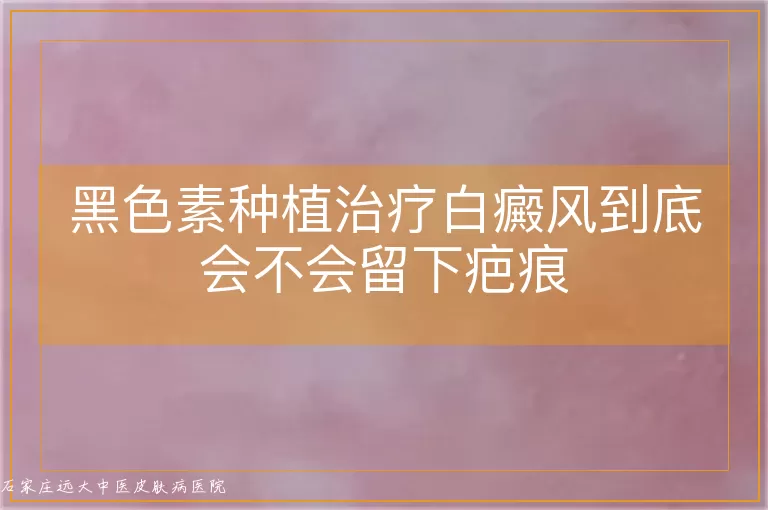 黑色素种植治疗白癜风到底会不会留下疤痕