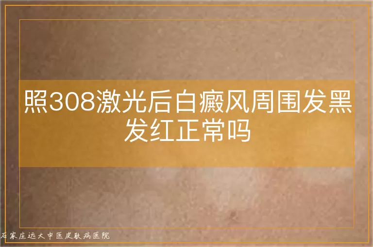 照308激光后白癜风周围发黑发红正常吗
