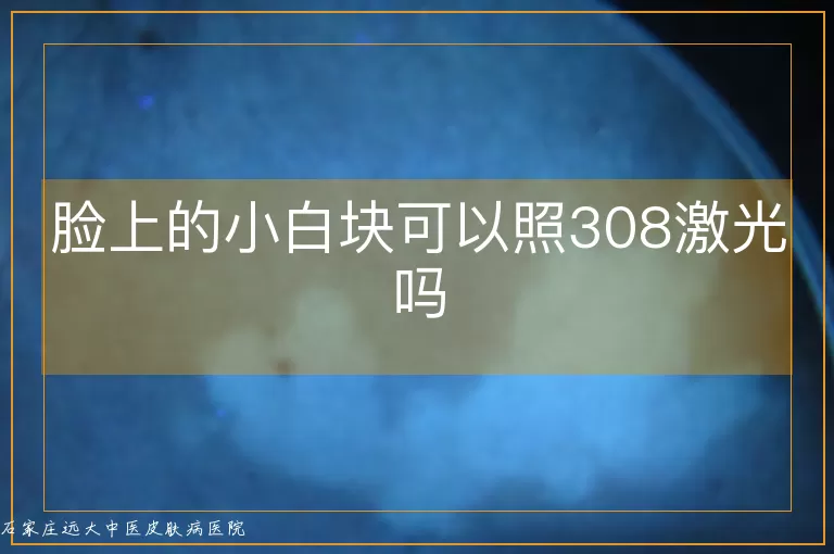 脸上的小白块可以照308激光吗