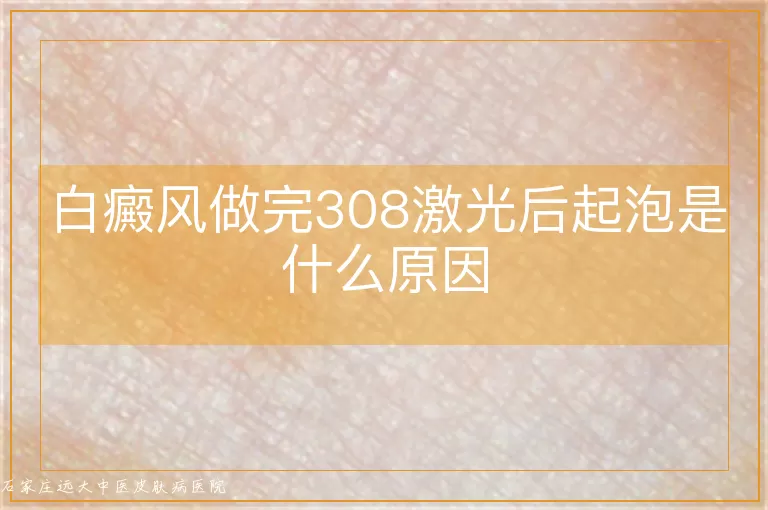 白癜风做完308激光后起泡是什么原因