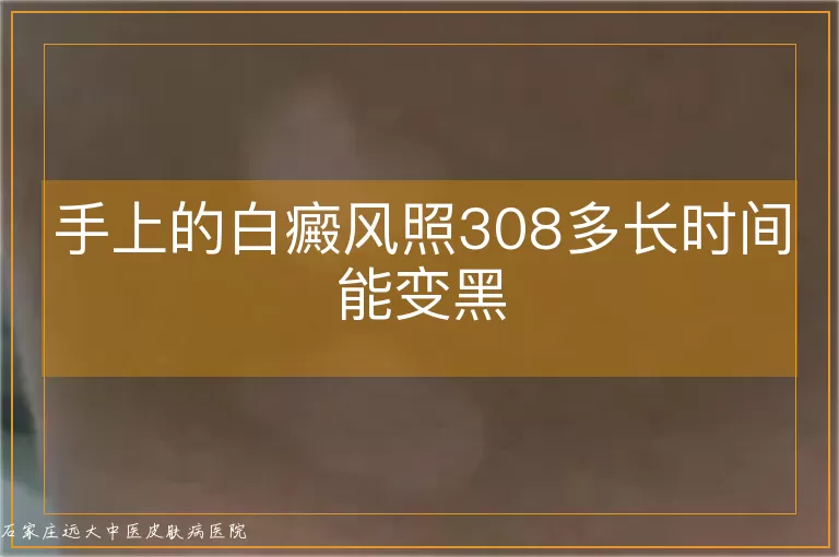 手上的白癜风照308多长时间能变黑