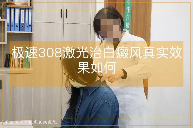 极速308激光治白癜风真实效果如何