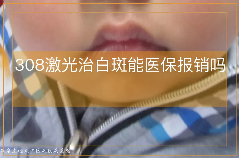308激光治白斑能医保报销吗