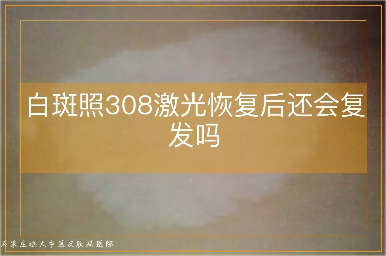 白斑照308激光恢复后还会复发吗