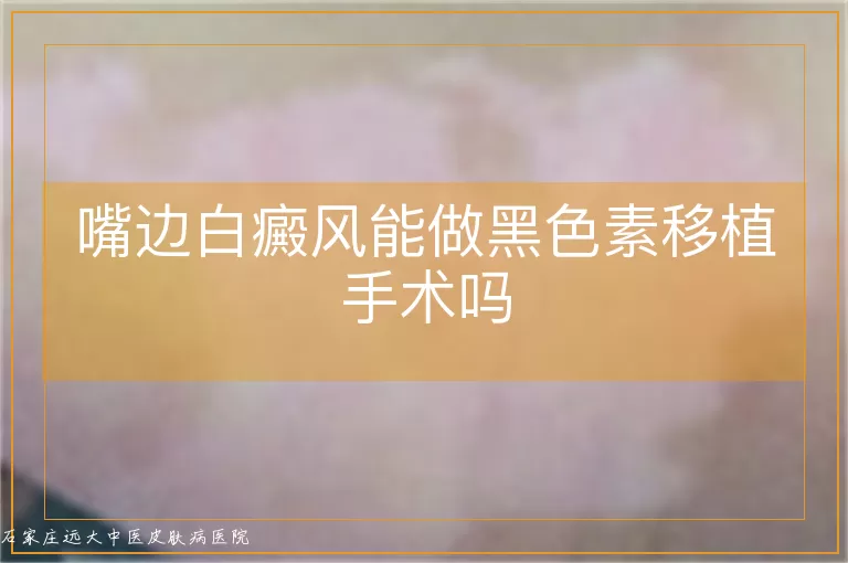 嘴边白癜风能做黑色素移植手术吗
