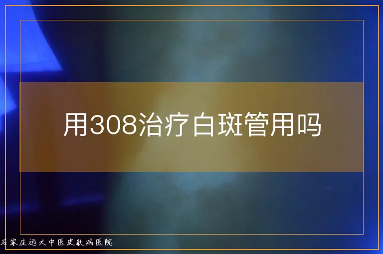 用308治疗白斑管用吗