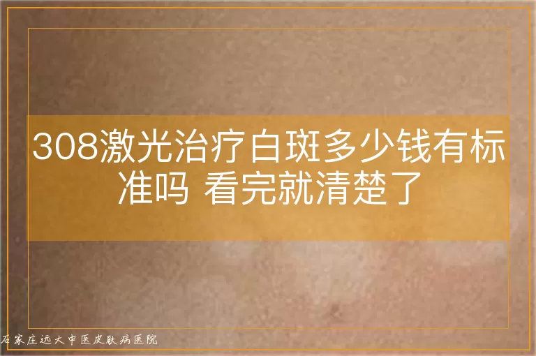 308激光治疗白斑多少钱有标准吗 看完就清楚了