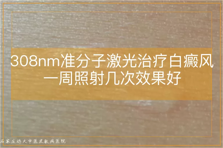 308nm准分子激光治疗白癜风一周照射几次效果好