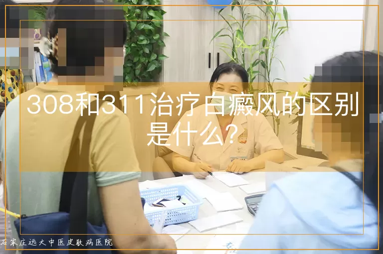 308和311治疗白癜风的区别是什么?
