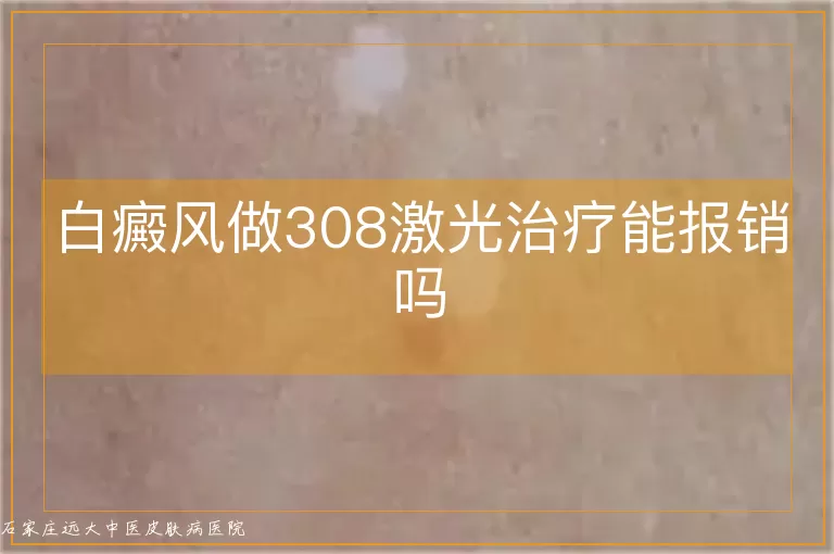 白癜风做308激光治疗能报销吗