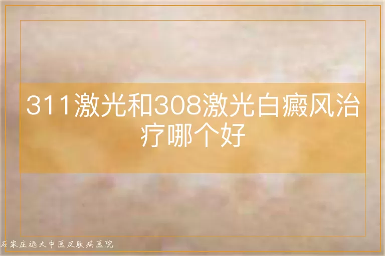 311激光和308激光白癜风治疗哪个好