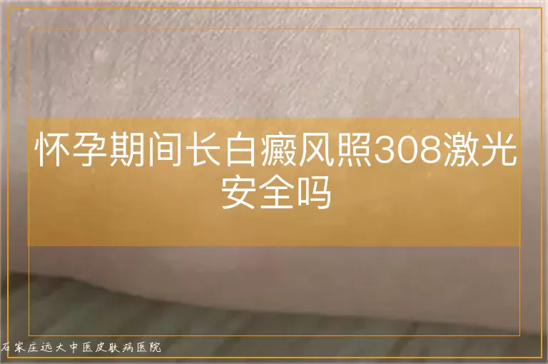 怀孕期间长白癜风照308激光安全吗