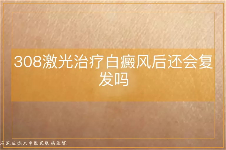 308激光治疗白癜风后还会复发吗