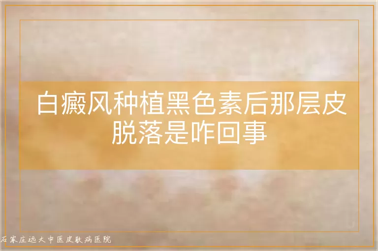 白癜风种植黑色素后那层皮脱落是咋回事