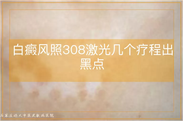 白癜风照308激光几个疗程出黑点