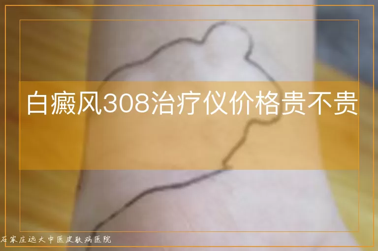 白癜风308治疗仪价格贵不贵