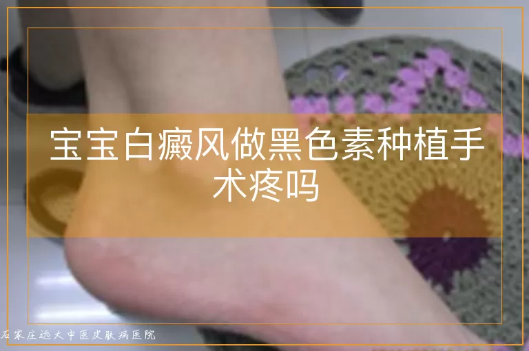 宝宝白癜风做黑色素种植手术疼吗