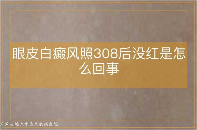 眼皮白癜风照308后没红是怎么回事
