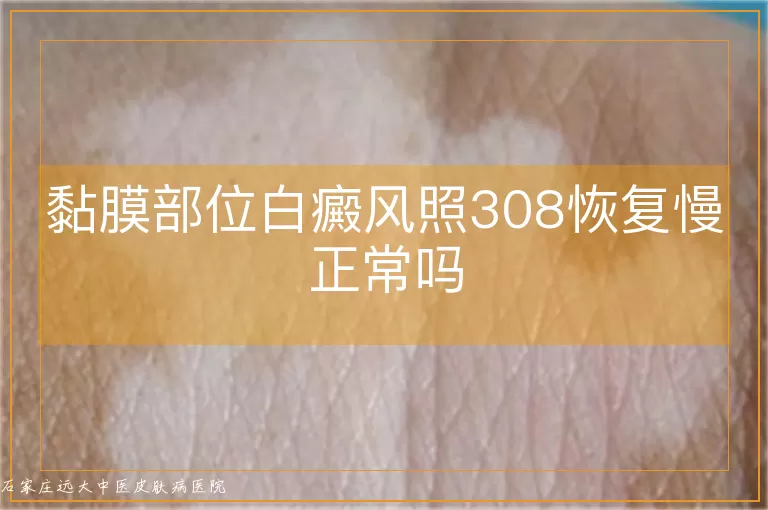 黏膜部位白癜风照308恢复慢正常吗