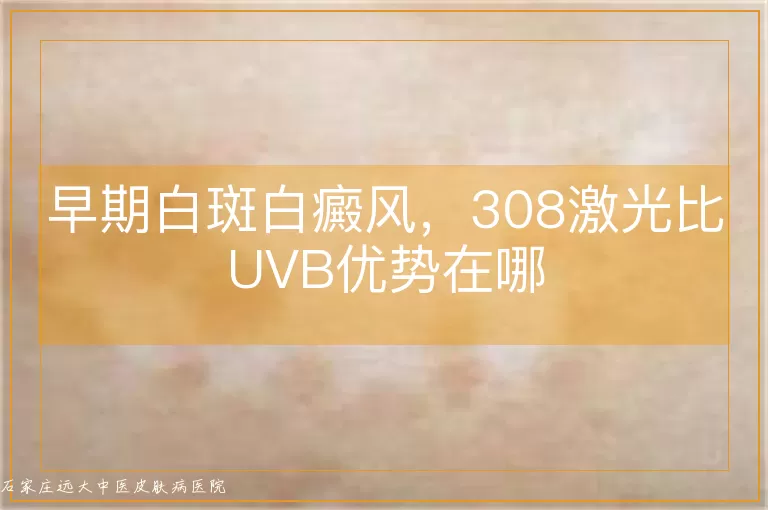 早期白斑白癜风，308激光比UVB优势在哪