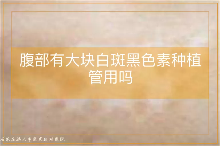 腹部有大块白斑黑色素种植管用吗