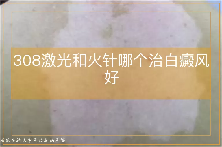 308激光和火针哪个治白癜风好