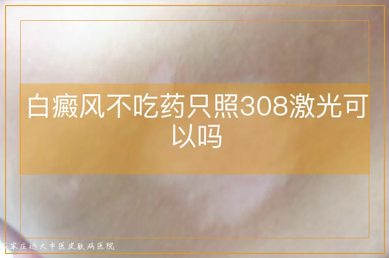 白癜风不吃药只照308激光可以吗