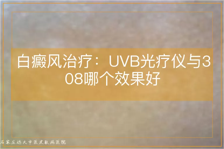 白癜风治疗:UVB光疗仪与308哪个效果好