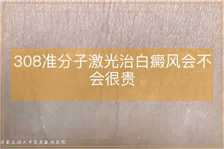308准分子激光治白癜风会不会很贵