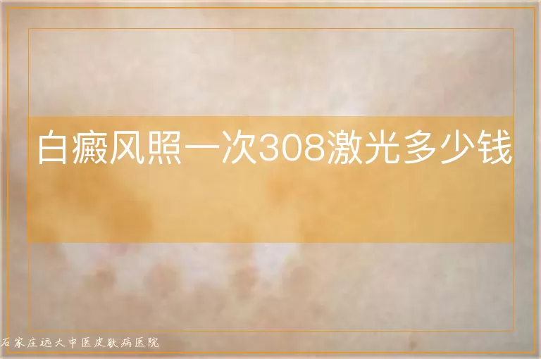 白癜风照一次308激光多少钱