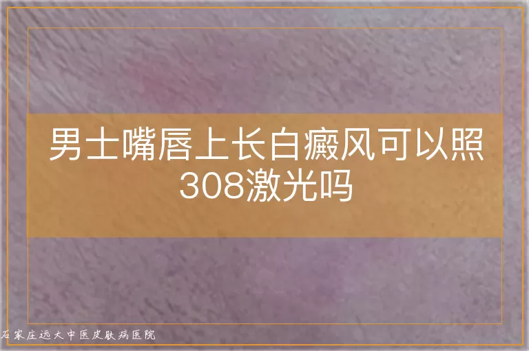 男士嘴唇上长白癜风可以照308激光吗